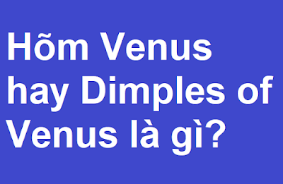 Hõm Venus ở nữ là gì?